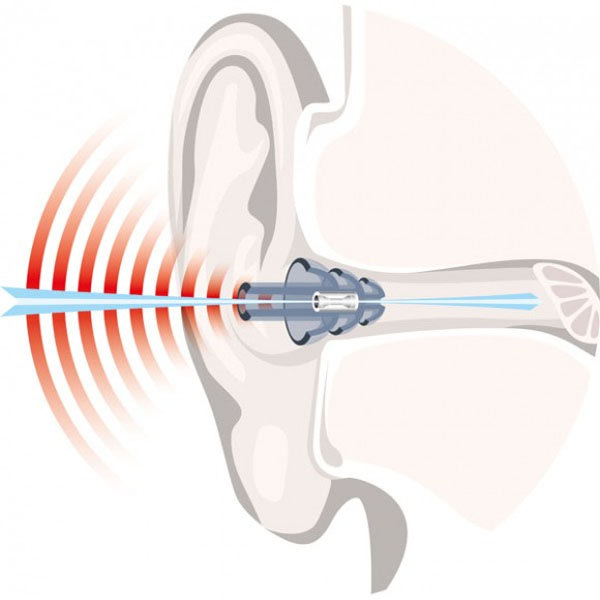 auritech-biker_ear-plugs_illustration1.jpg